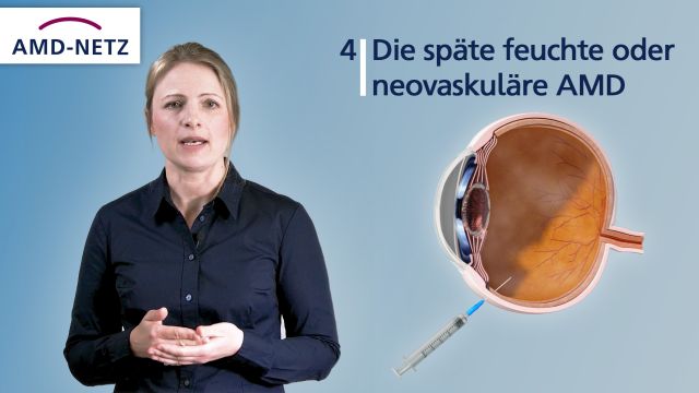 Filmausschnitt Frau erklärt Augenerkrankung