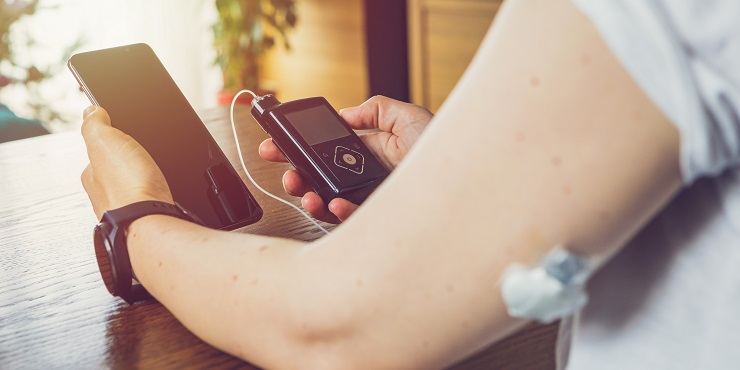 Symbolbild, Mensch mit Diabetes trägt ein CGM am Oberarm und hält in der einen Hand einen Insulinpumpe und in der anderen ein Smartphone