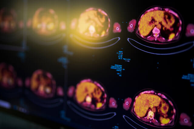 © SMPTY - stock.adobe.com