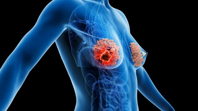 © Sebastian Kaulitzki - stock.adobe.com