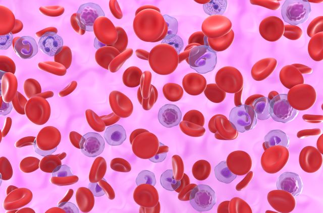 Hoher Gehalt an roten Blutkörperchen bei Polyzythämie vera (PV) – isometrische Ansicht, 3D-Illustration