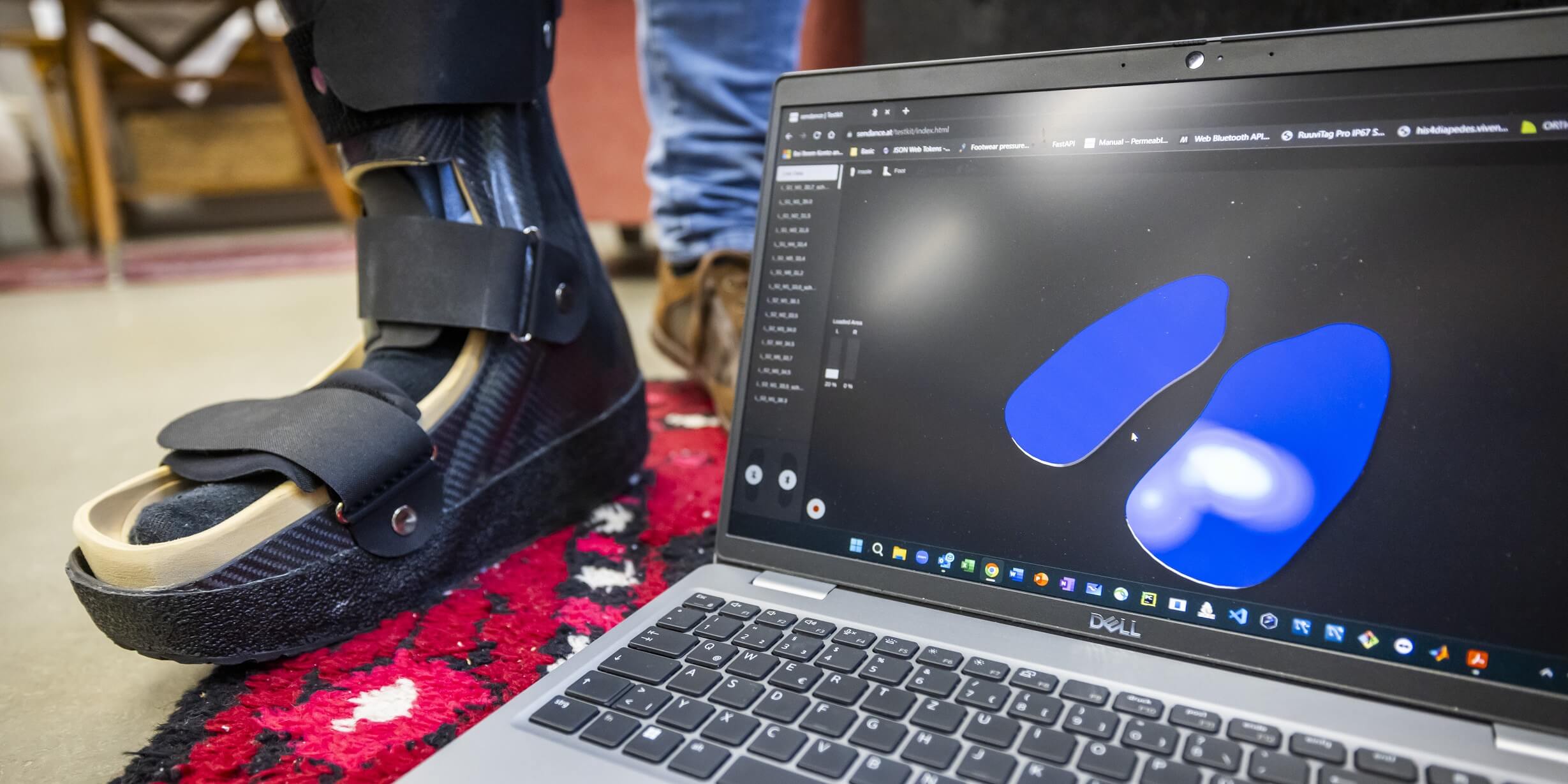 Die "smarte Orthese" erkennt unter anderem, ob die Orthese drückt oder ob sich der Druck des Körpergewichts gut verteilt.