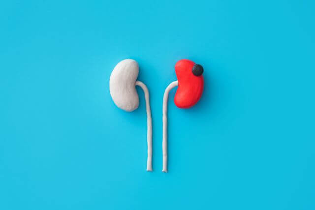 Neue Daten vom SCO GU 2024 zeigen robuste Vorteile von Kombinationstherapien in Bezug auf progressionsfreies Überleben, Gesamtüberleben und Ansprechraten. (Symbolbild © Adobestock – Андрей К)