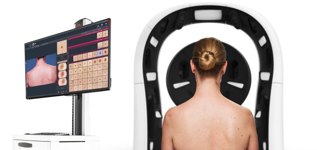 Hautkrebsvorsorge mit dem Ganzkörperscanner im iToBoS-Projekt