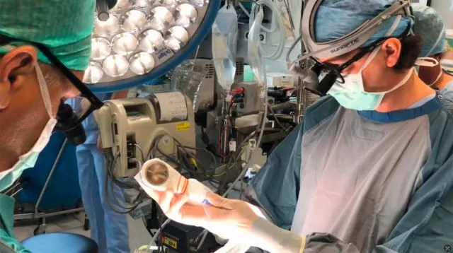 Einsatz des Gerätes in einer OP-Situation