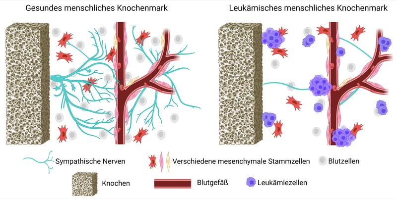 Vereinfachtes Schema des gesunden und leukämischen menschlichen Knochenmarks. Leukämie führt zur Schädigung und zum Verlust von Nerven, was das Gleichgewicht der Blutzellenentwicklung stören kann. Abbildung erstellt mit BioRender. © Tatyana Grinenko and Iryna Kovtun