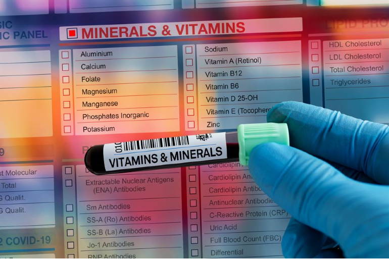 Blutprobe mit der Aufschrift "Vitamins & Minerals" vor einem Computerscreen