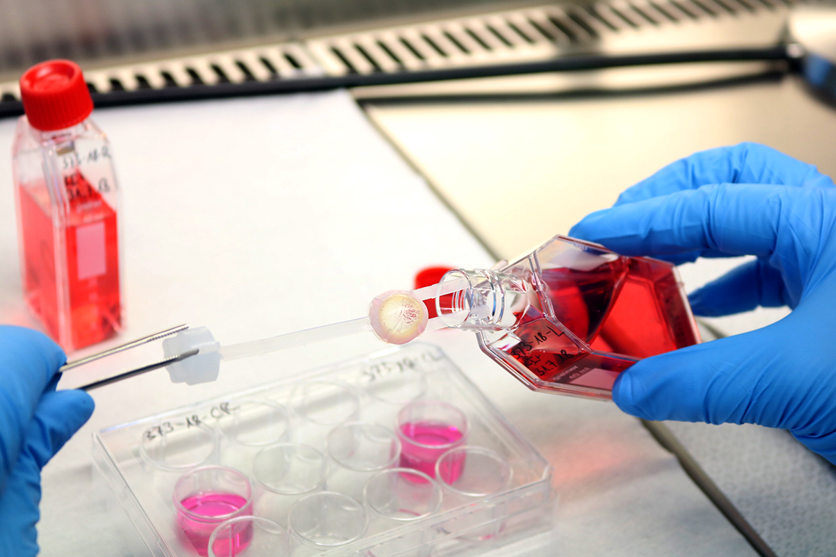 Aufbereitung einer Spenderhornhaut im Labor