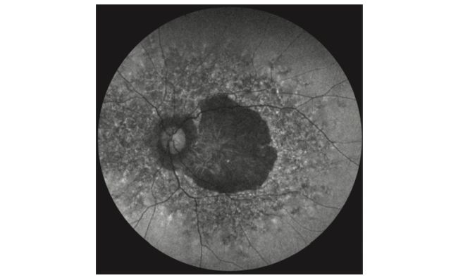 Makula-Aufnahme
