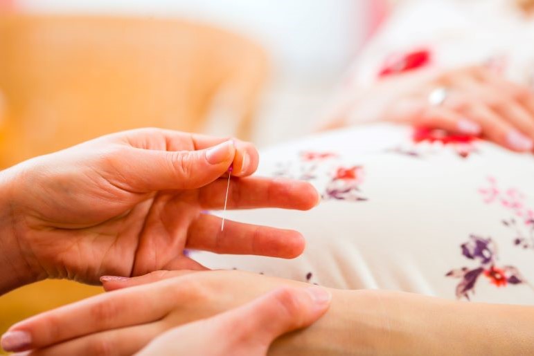 Akupunktur zur nicht medikamentösen Geburtseinleitung: Hände setzen Nadel am Handgelenk.