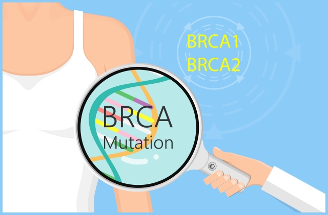 Illustration der BRCA1/BRCA2-Mutation und ihrer Rolle bei Brustkrebs mit Fokus auf genetische Marker.