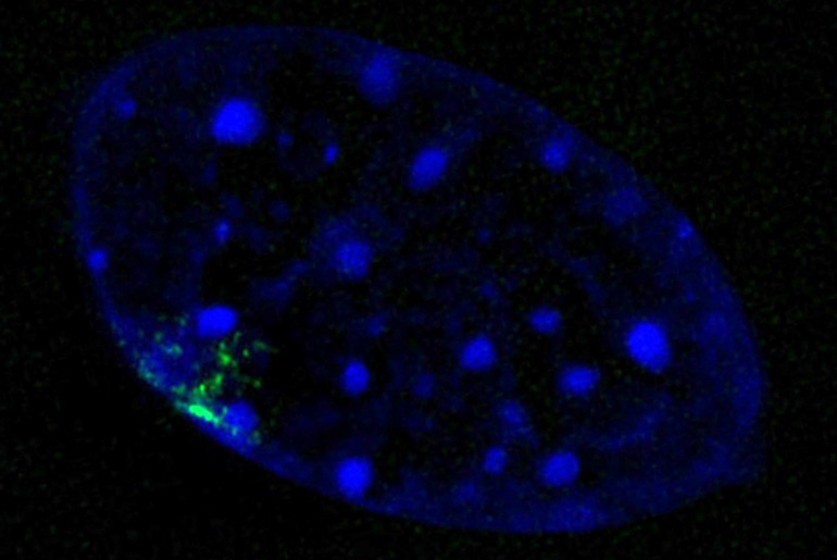 Der Zellkern eines Barr-Körperchen, das DNA bündelt.