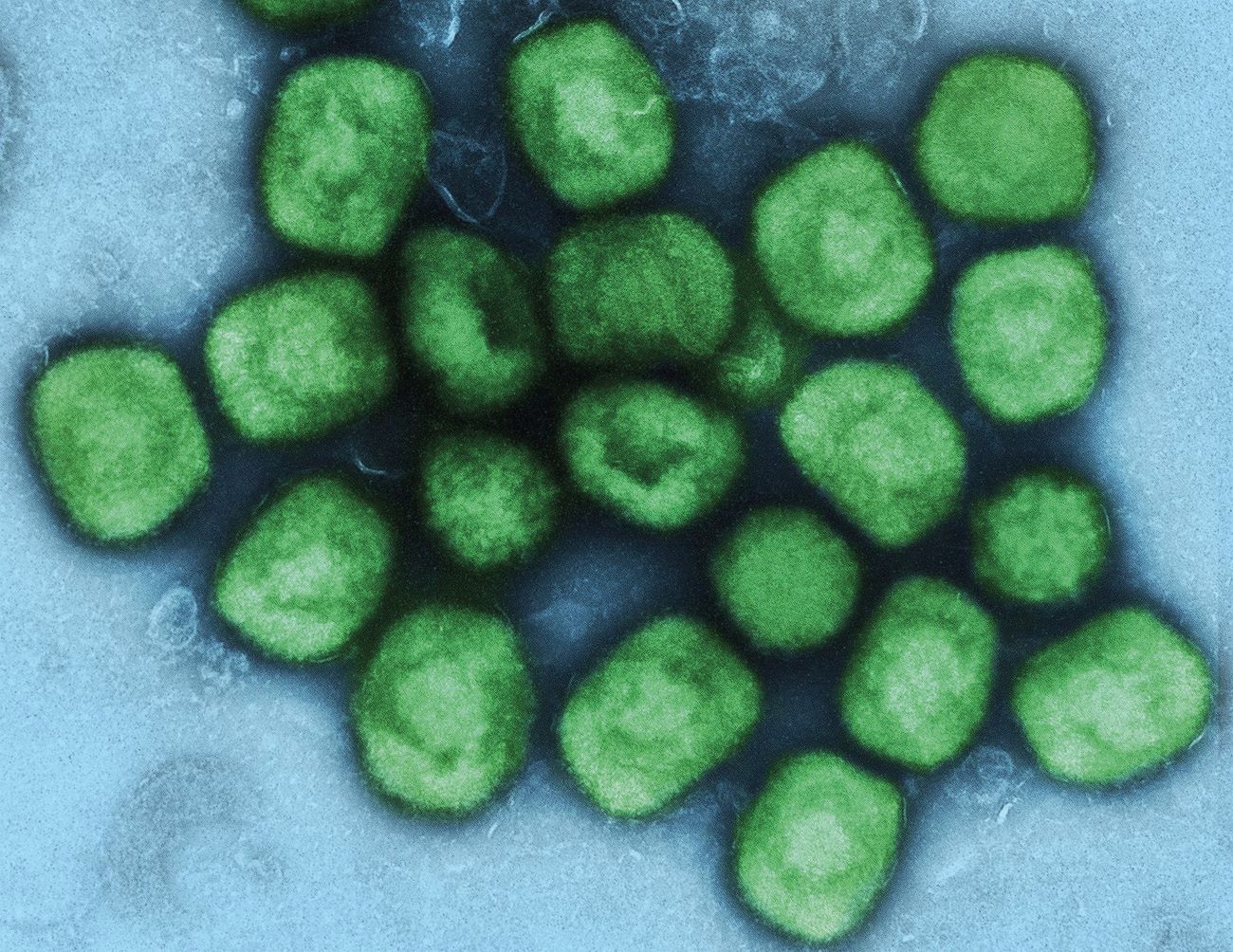 © National Institute of Allergy and Infectious Diseases (NIAID)