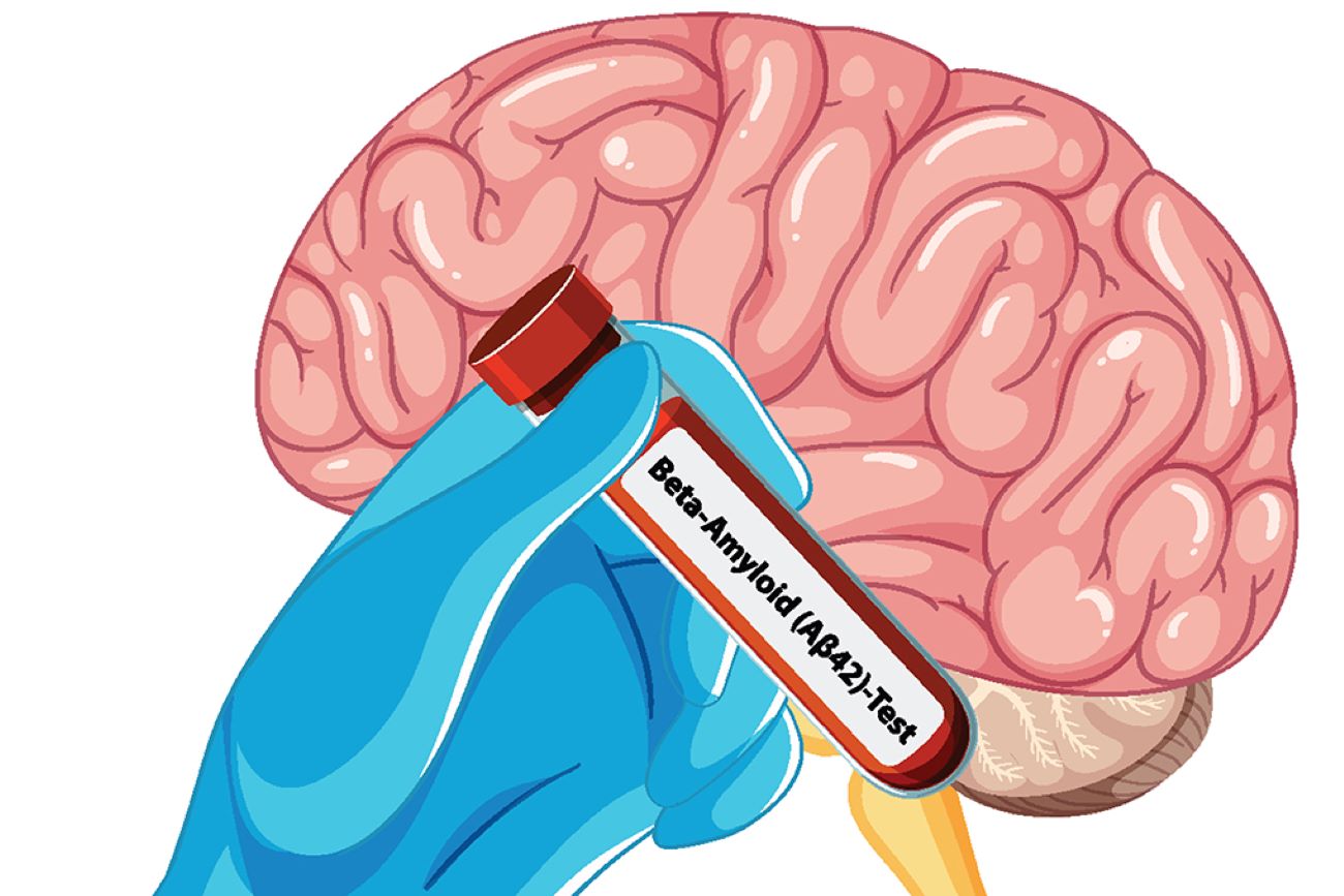 © blueringmedia – stock.adobe.com