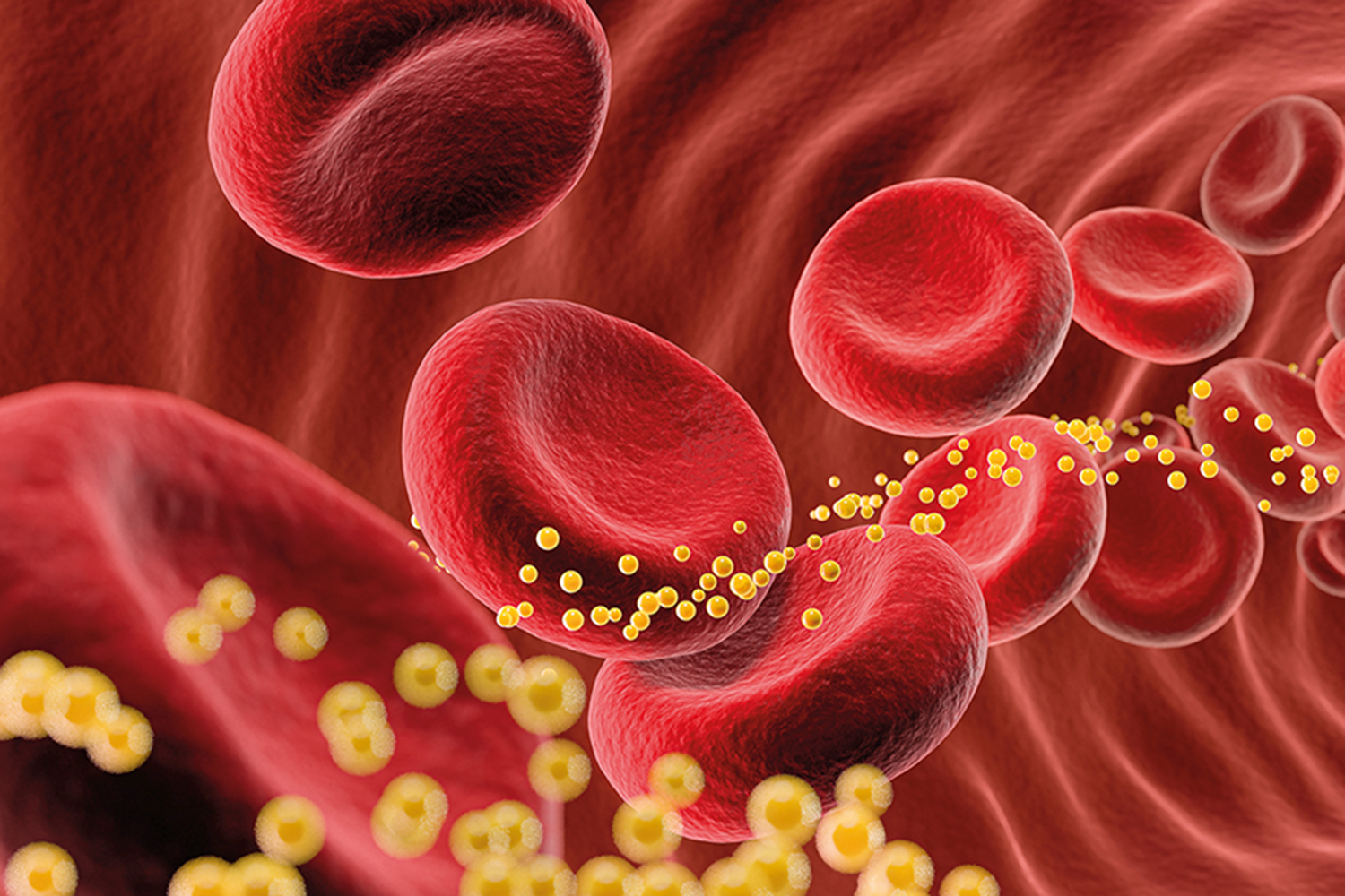 Blutblättchen mit Lipiden