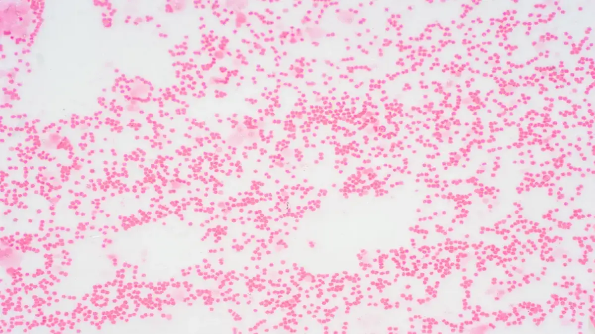 Mikroskopische Aufnahme von Zellen, die für die Diagnostik und Therapie von Myelofibrose und Anämie relevant sind.