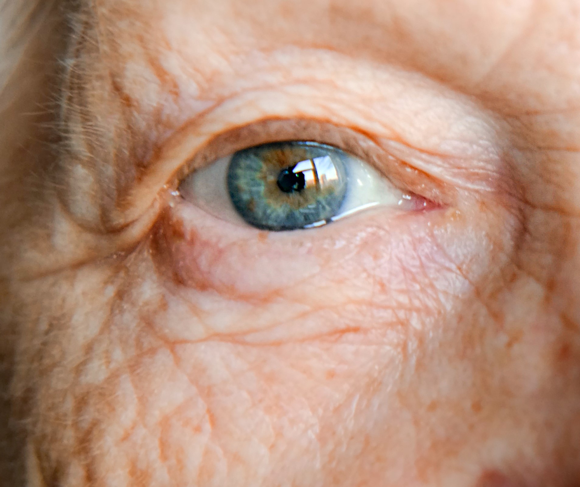 Auge einer älteren Frau mit blauer Iris_Symbolfoto für alterndes Auge