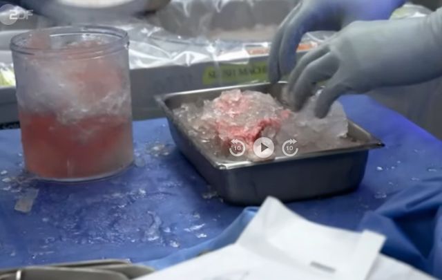 Seit mehr als 60 Tagen lebt die US-Patientin Towana Looney bereits mit einer Schweineniere (Foto). Kommt der Durchbruch in der Xenotransplantation? Quelle: heute.de