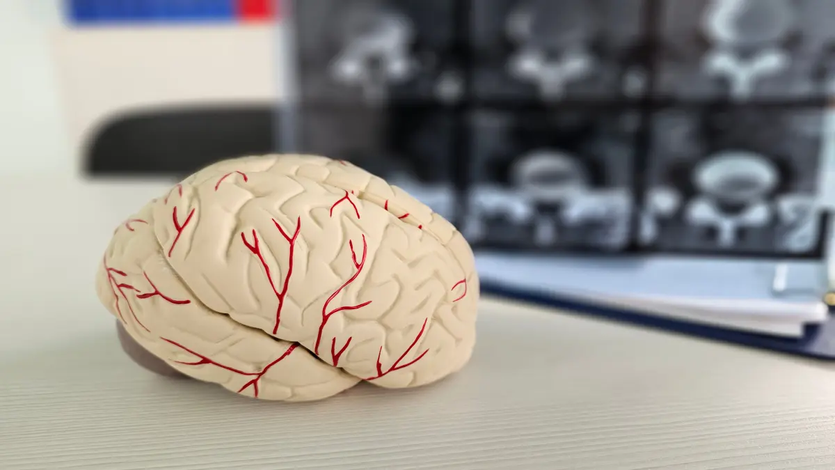 Educational model of human brain displayed with MRI scans in clinical