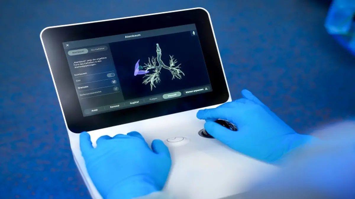 Die Software des Systems erzeugt einen „digitalen Zwilling“ der Atemwege und berechnet den sichersten Weg zur verdächtigen Stelle – vergleichbar mit einem Auto-Navigationssystem