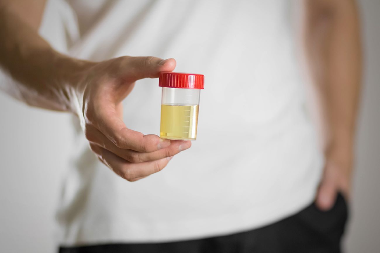 © OB production_stock.adobe.com