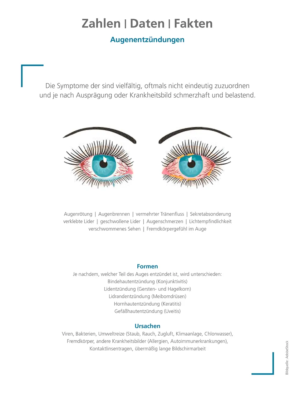 Augenentzündungen