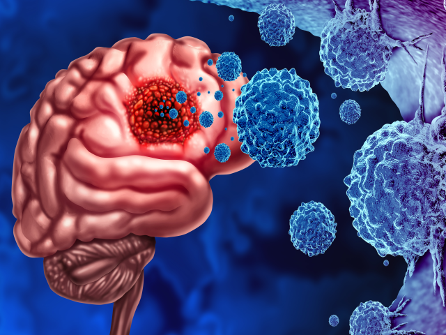 3D-Illustration von Tumorzellen im Gehirn, angegriffen von Immunzellen vor einem blauen Hintergrund.