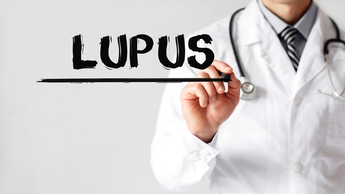 Arzt schreibt das Wort Lupus mit einem Marker