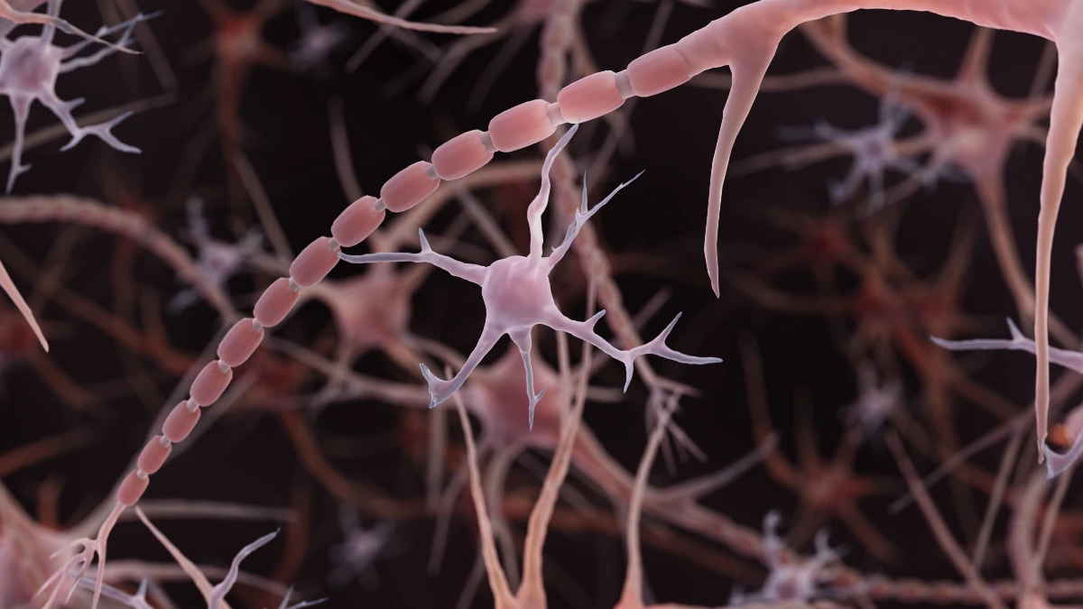 Rosa eingefärbte Mikroglia, Symbolbild für Multiple Sklerose.