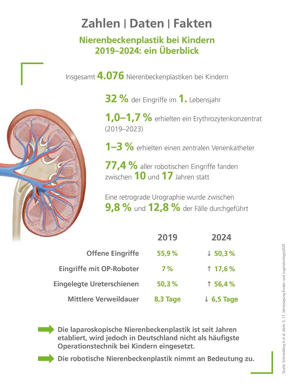 Nierenbeckenplastik bei Kindern 2019–2024: ein Überblick