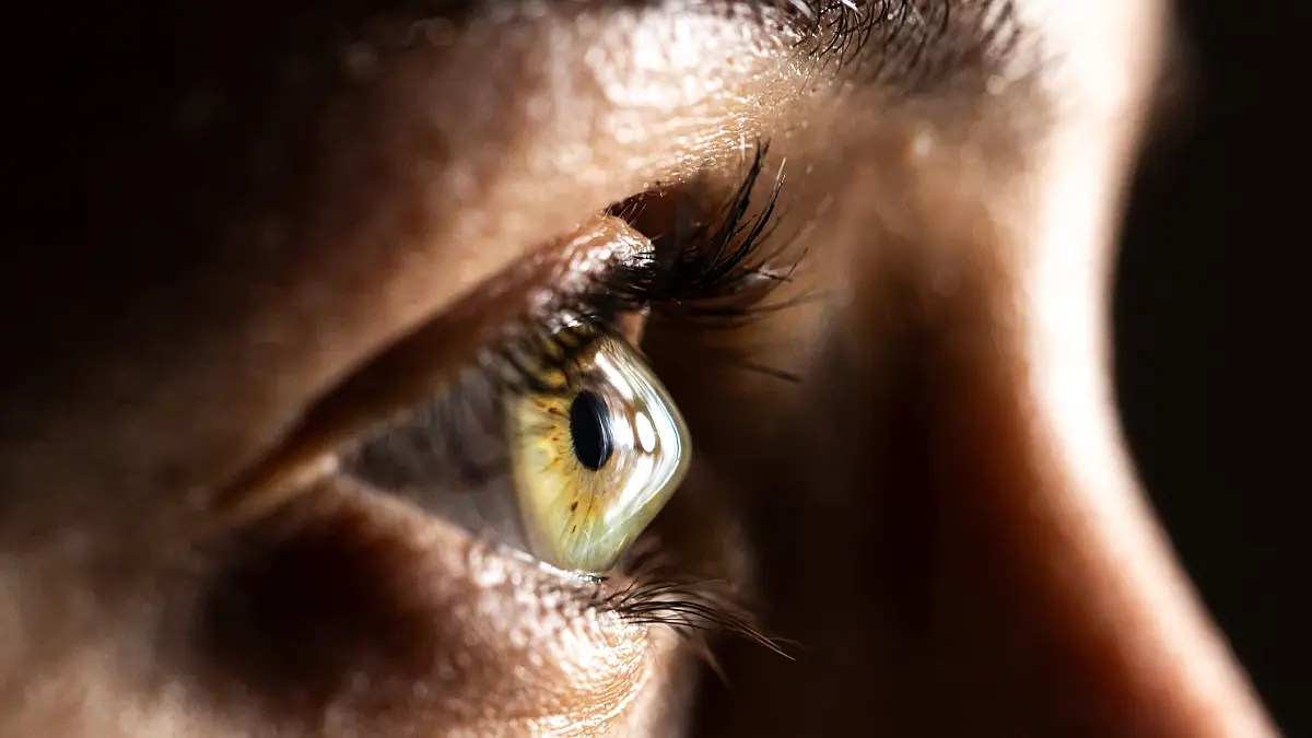 Junge Frau. Nahaufnahme eines Keratokonus. Foto: Adobe Stock - Alessandro Grandini