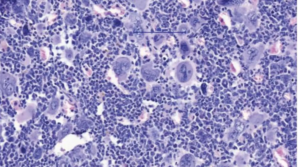 Histologische Gewebeaufnahme unter dem Mikroskop bei 100-facher Vergrößerung