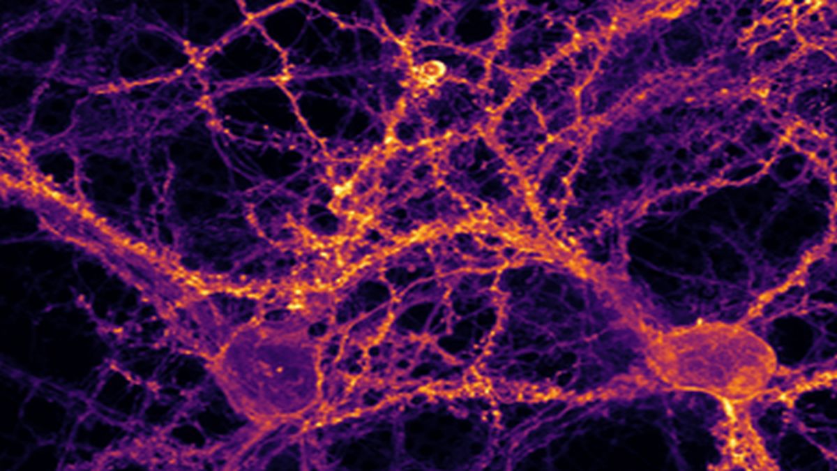 . © Charité/Max Delbrück Center | Jana Kroll