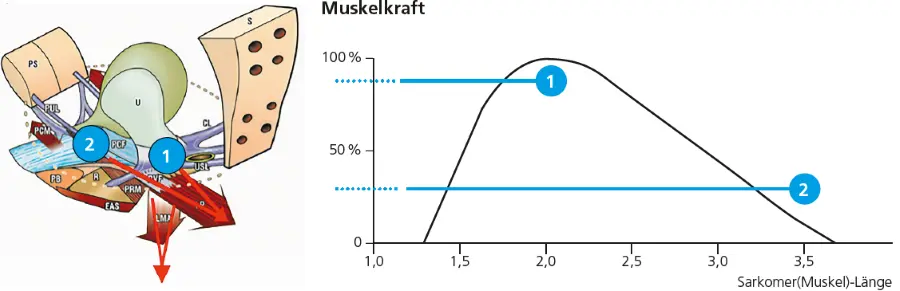 Abb. 3. Schematische Darstellung wichtiger Ligamente, Beckenbodenmuskeln und Organe: CL: kardinales Ligament; USL: sakrouterines Ligament; PUL: pubourethrales Ligament; PB: Perinealkörper; PCF: pubozervikale Faszie; LP: Levatorplatte; LMA: longitudinaler Muskel des Anus; PRM: M. puborektalis; PCM: M. pubococcygeus; EAS: extraanaler Sphinkter; U: Uterus; PS: Symphyse; S: Sakrum. Die Kurve rechts zeigt die Abhängigkeit der Muskelkraft von der Sarcomer-(Muskel) Länge. Dargestellt ist, wie sich eine individuelle Muskelfaser der Levatorplatte in Position 1 (normale Lage des Uterus) bei normaler Länge optimale Muskelkraft entwickelt (Kurve rechts). Deszendiert die Zervix zu Position 2, kann die Muskelfaser gedehnt werden, was zur Verringerung der Muskelkraft führt (Position 2 in der Kurve rechts).
