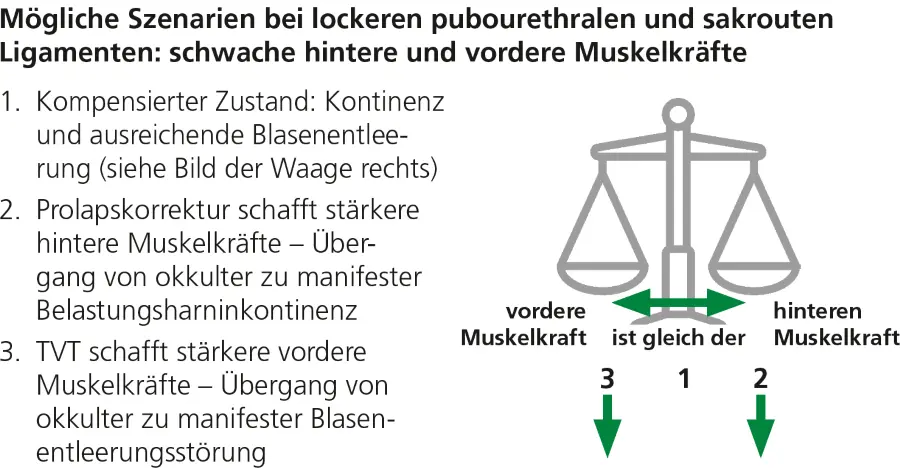 Abb. 4: Szenarien bei lockeren pubourethralen und sakrouterinen Ligamenten, wodurch sowohl die vorderen als auch die hinteren Muskelkräfte geschwächt sind.