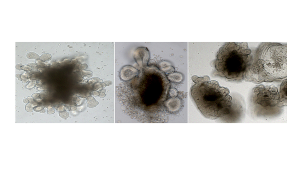 Organoide in der präklinischen Krebsforschung des BZKF