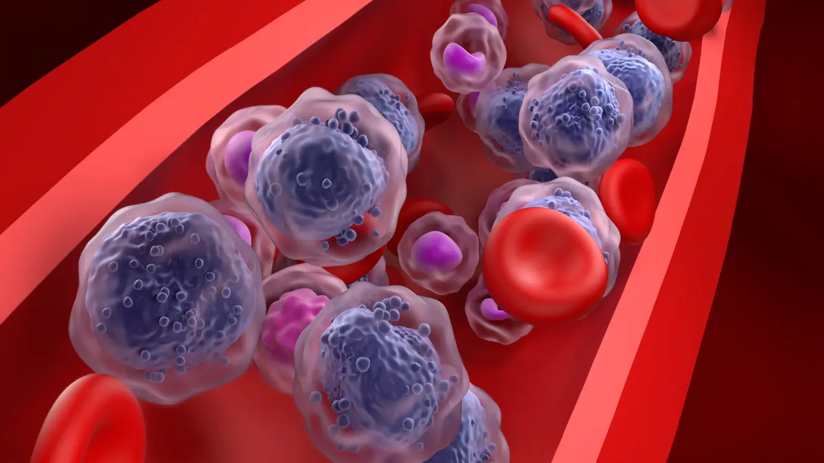 3D-Illustration von Blutzellen und Leukämiezellen in einem Blutgefäß – Symbolbild für akute myeloische Leukämie und medizinische Forschung