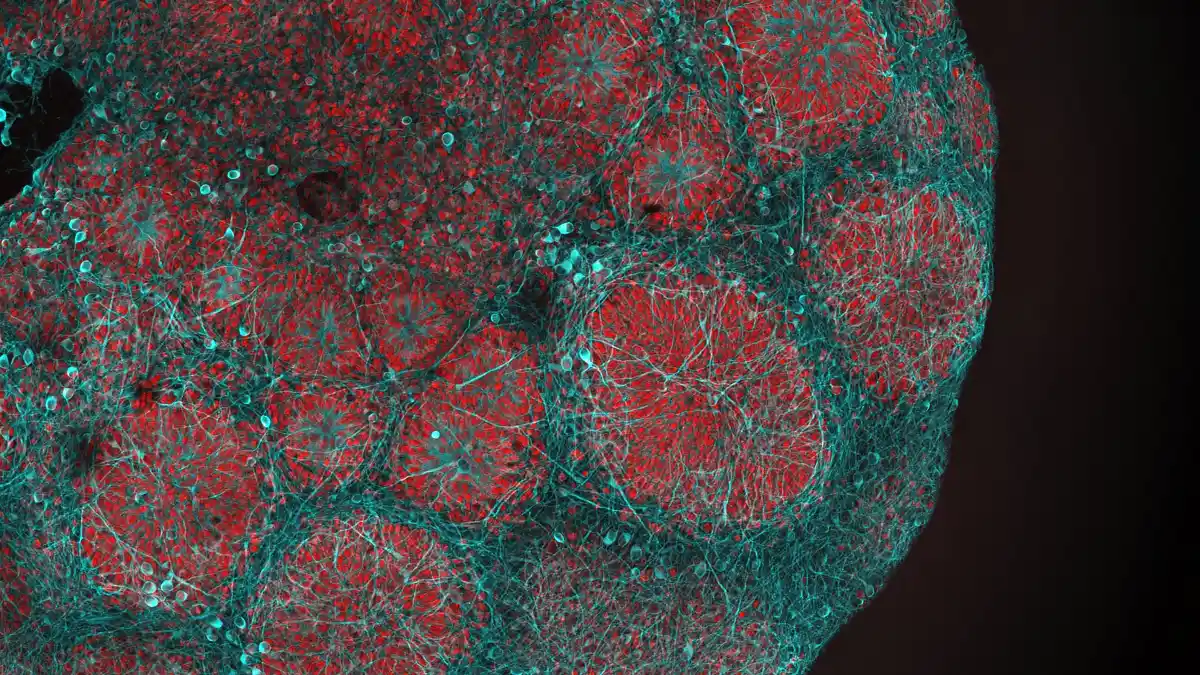 Mikroskopaufnahme eines dreidimensionalen Hirnorganoids, wie es in der Studie eingesetzt wurde.