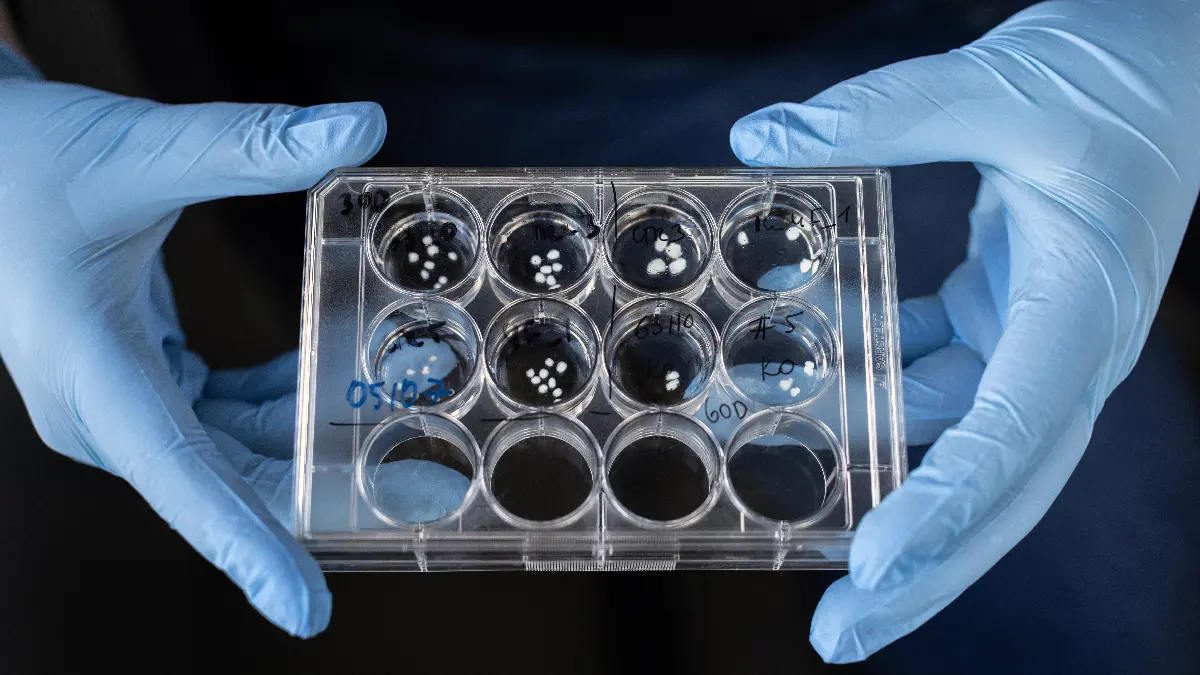 30 und 60 Tage alte Hirn-Organoide in der Petrischale. © Einstein Stiftung Berlin | Pablo Castagnola