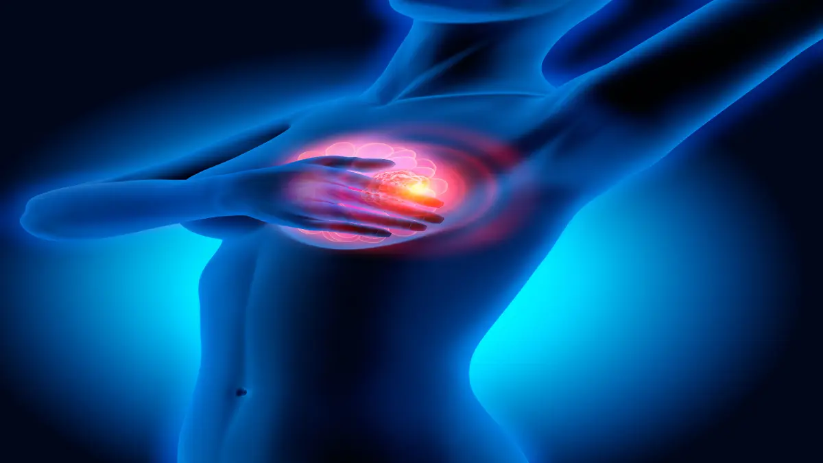 Alt-tag: 3D-Illustration: Weiblicher Oberkörper im Röntgenstil mit sichtbarem leuchtendem Brusttumor bei der Brustuntersuchung