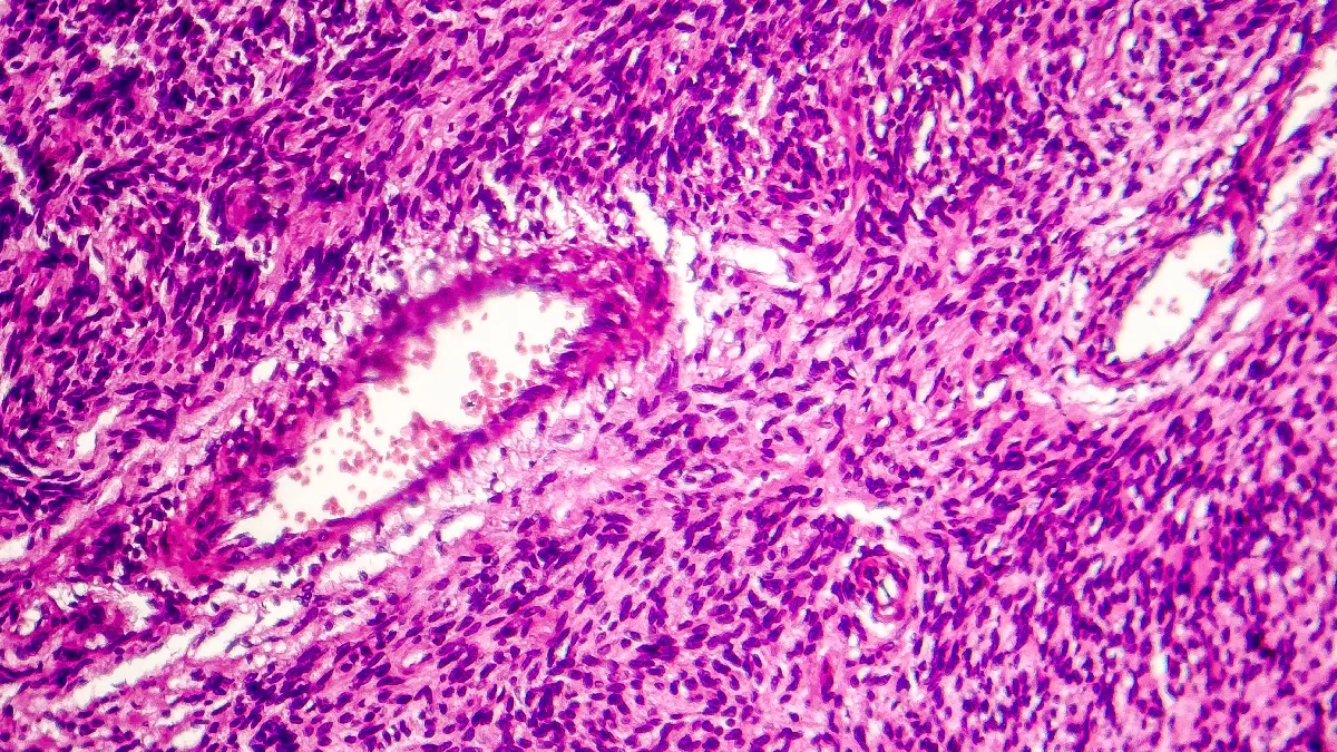 Histologische Gewebeaufnahme unter dem Mikroskop in Hae-Eosin-Faerbung