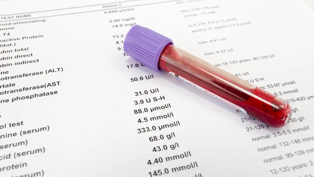 Blutröhrchen auf einem Laborbefund mit Laborwerten – Symbolbild für hsCRP-Messung zur Diagnostik kardiovaskulärer Inflammation
