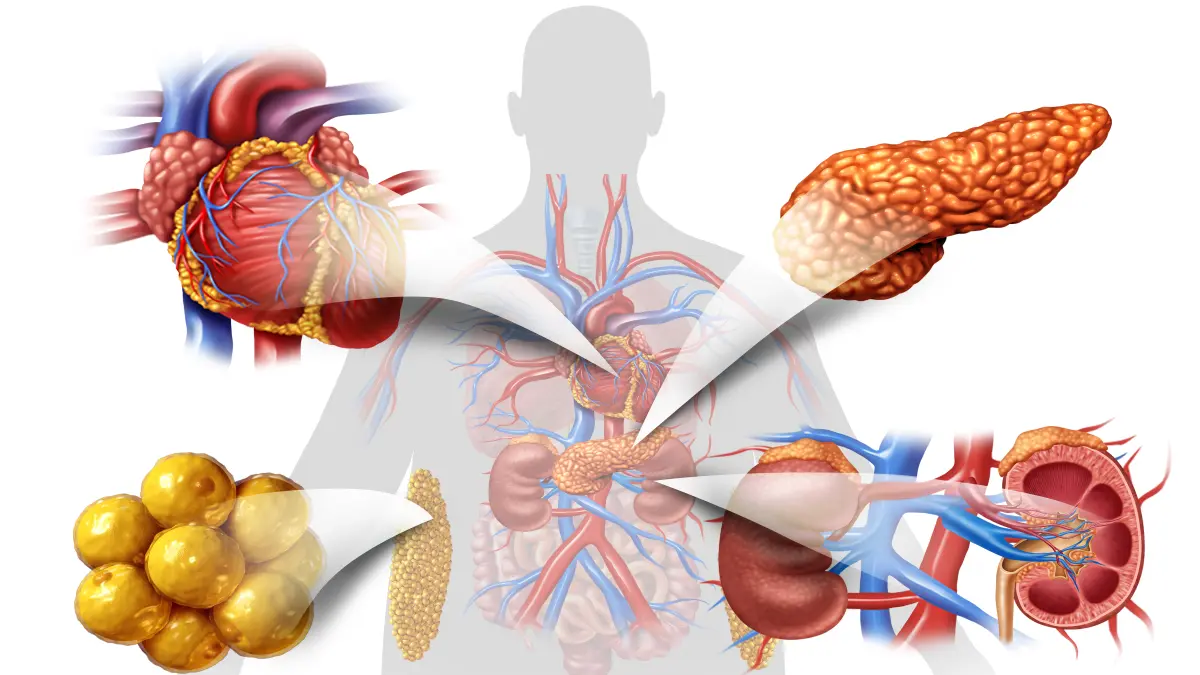Illustration zum kardiometabolischen Syndrom mit Herz, Niere, Bauchspeicheldruese und Fettgewebe