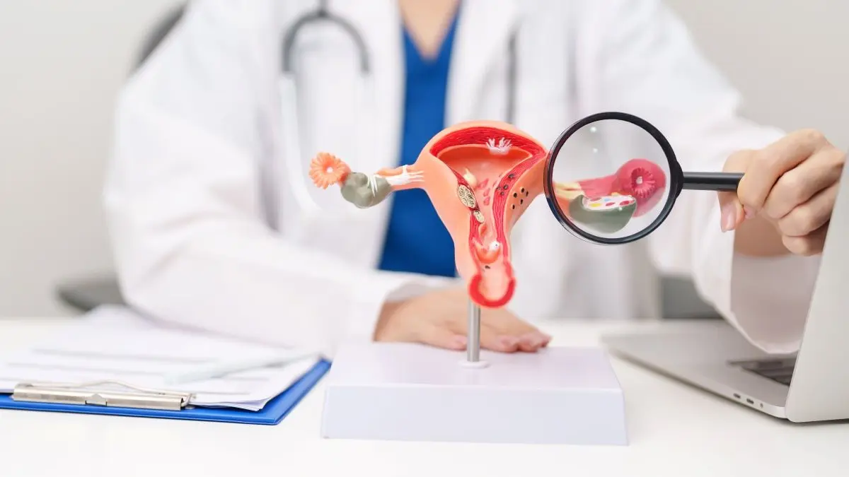 Aerztin erklaert Uterusmodell zur Diagnostik und Therapie der Endometriose