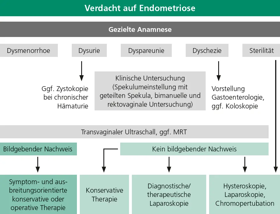 Abb. 1: Diagnostisches Vorgehen bei Verdacht auf Endometriose. Darstellung der schrittweisen Abklärung von der Anamnese und klinischen Untersuchung über sonographische und ggf. MRT-Diagnostik bis zur diagnostischen bzw. therapeutischen Laparoskopie.