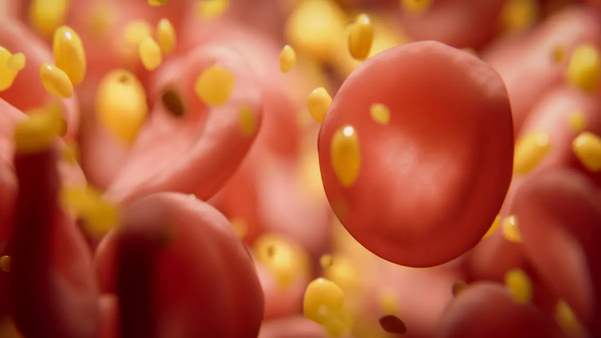 3D-Illustration von Erythrozyten und Lipidpartikeln im Blutgefäß – Symbol für erhöhtes LDL-Cholesterin