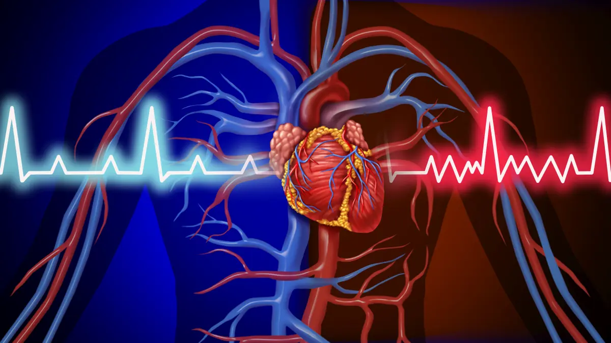 Medizinische Illustration eines menschlichen Herzens mit Blutgefäßen und EKG-Kurve, symbolisiert Herzinsuffizienz und kardiovaskuläre Therapie