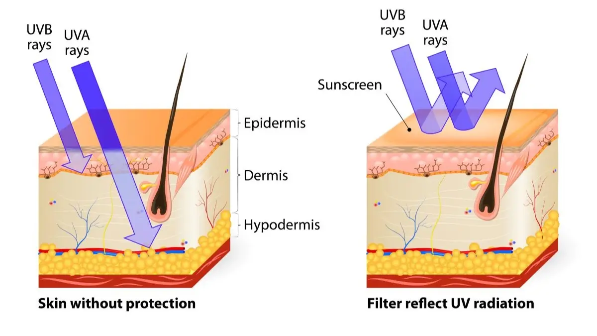 Grafik zeigt wie UVA und UVB Strahlen in die Hautschichten eindringen und wie Sonnenschutz die UV Strahlung reflektiert, Symbolbild fuer Hautkrebs Praevention