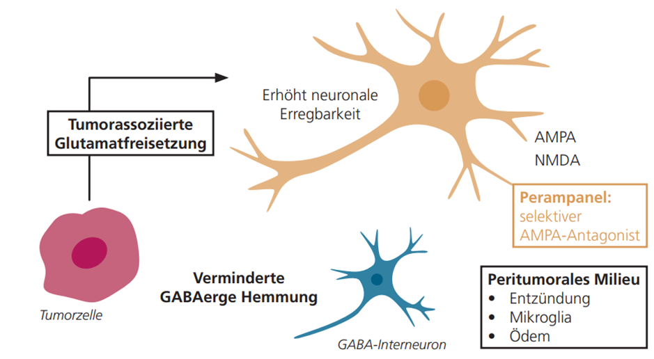 Schematische Darstellung der Pathophysiologie der tumorassoziierten Epilepsie (BTRE). Gliomzellen setzen vermehrt Glutamat frei, das über AMPA- und NMDA-Rezeptoren eine Hyperexzitabilität der peritumoralen Neuronen bewirkt. Gleichzeitig wird die inhibitorische GABAerge Transmission reduziert. Die resultierende Imbalance zwischen Erregung und Hemmung führt zur Ausbildung epileptischer Aktivität. Perampanel blockiert selektiv AMPA-Rezeptoren und kann so die glutamaterge Übererregung und Anfallsentstehung modulieren.