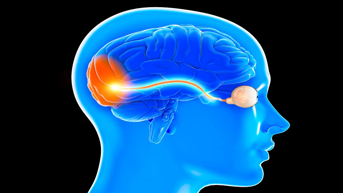 Optikusneuritis